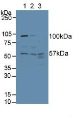 Western Blot; Sample: Recombinant ALT, Human.