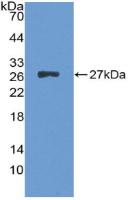 DAB staining on IHC-P; Samples: Human Liver Tissue; Primary Ab: 10µg/ml Rabbit Anti-Human ALT Antibody Second Ab: 2µg/mL HRP-Linked Caprine Anti-Rabbit IgG Polyclonal Antibody