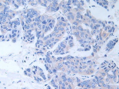 Alanine Aminotransferase (ALT) Polyclonal Antibody - image 5
