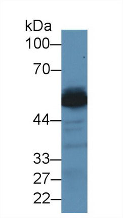 Western Blot; Sample: Mouse Kidney lysate; ;Primary Ab: 2µg/ml Rabbit Anti-Human ALT Antibody;Second Ab: 0.2µg/mL HRP-Linked Caprine Anti-Rabbit IgG Polyclonal Antibody;