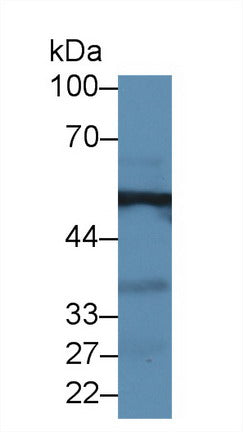Alanine Aminotransferase (ALT) Polyclonal Antibody - image 3
