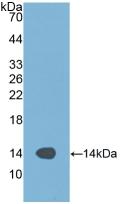 Alanine Aminotransferase (ALT) Polyclonal Antibody - image 3