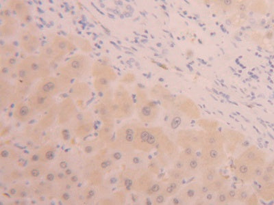 Alanine Aminotransferase (ALT) Polyclonal Antibody - image 5
