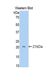 Growth Arrest Specific Protein 6 (GAS6) Polyclonal Antibody - image 2