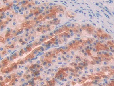 Growth Arrest Specific Protein 6 (GAS6) Polyclonal Antibody - image 4