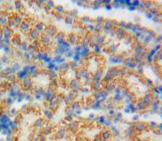 Growth Arrest Specific Protein 6 (GAS6) Polyclonal Antibody - image 3