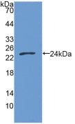 DAB staining on IHC-P; Samples: Human Thyroid cancer Tissue;  Primary Ab: 20µg/ml Rabbit Anti-Human