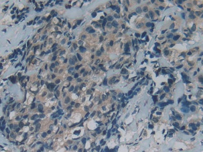 Growth Arrest Specific Protein 6 (GAS6) Polyclonal Antibody - image 5