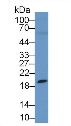 Western Blot; Sample: Recombinant protein.
