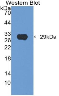 Used in DAB staining on fromalin fixed paraffin-embedded Kidney tissue