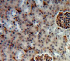 Hexosaminidase A Alpha (HEXa) Polyclonal Antibody - image 4