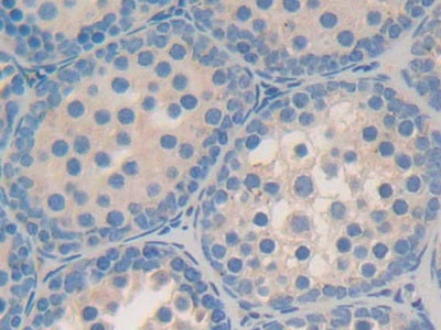 Galactosidase Alpha (GLa) Polyclonal Antibody - image 3