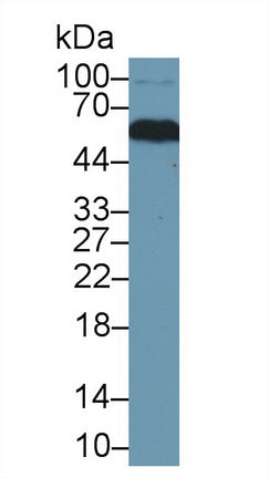 Western Blot; Sample: Recombinant protein.