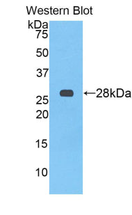 DAB staining on IHC-P; Samples: Rat Liver Tissue; Primary Ab: 20μg/ml Rabbit Anti-Rat aHSG Antibody Second Ab: 2µg/mL HRP-Linked Caprine Anti-Rabbit IgG Polyclonal Antibody