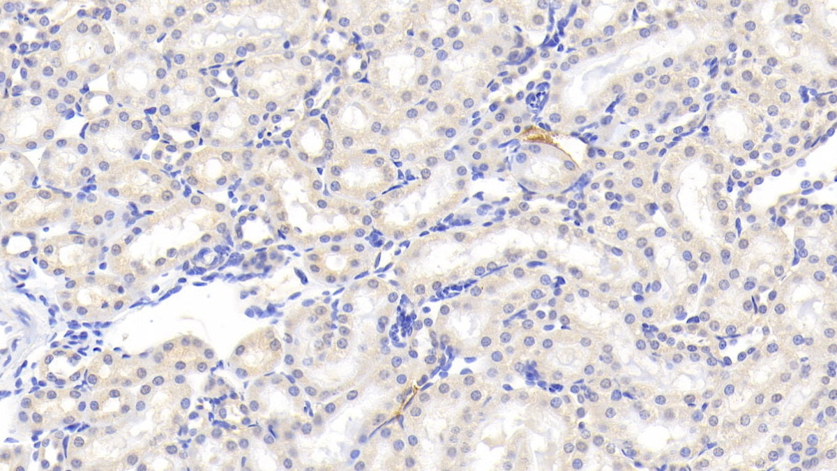 Alpha-2-Heremans Schmid Glycoprotein (AHSG) Polyclonal Antibody - image 5