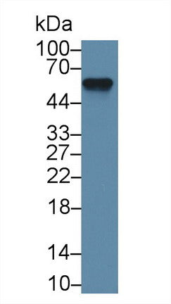 Western Blot; Sample: Recombinant protein.