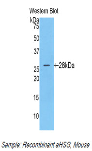 DAB staining on IHC-P; Samples: Mouse Cardiac Muscle Tissue; Primary Ab: 10µg/ml Rabbit Anti-Mouse aHSG Antibody Second Ab: 2µg/mL HRP-Linked Caprine Anti-Rabbit IgG Polyclonal Antibody