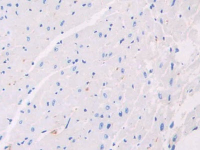 DAB staining on fromalin fixed paraffin- embedded kidney tissue)