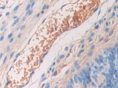 Alpha-2-Heremans Schmid Glycoprotein (AHSG) Polyclonal Antibody - image 5