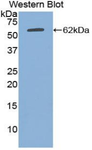DAB staining on IHC-P; Samples: Human Kidney Tissue;  Primary Ab: 30µg/ml Rabbit Anti-Human aHSG Antibody Second Ab: 2µg/mL HRP-Linked Caprine Anti-Rabbit IgG Polyclonal Antibody