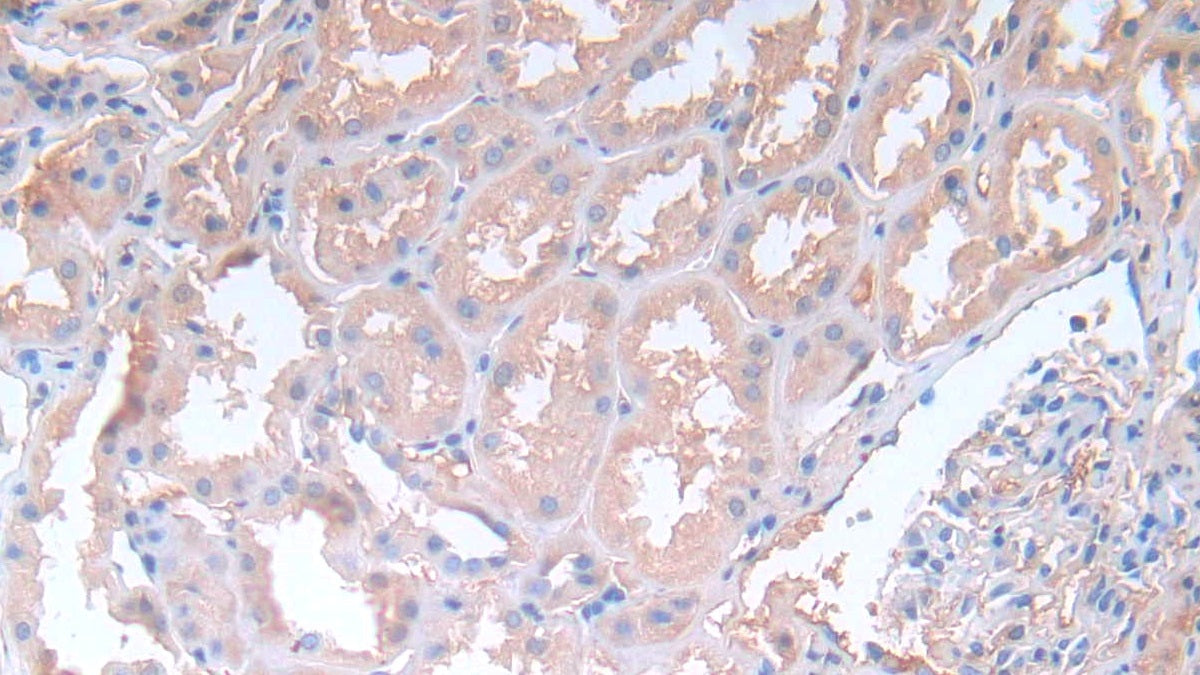Alpha-2-Heremans Schmid Glycoprotein (AHSG) Polyclonal Antibody - image 4