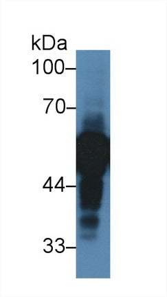 Western Blot; Sample: Recombinant protein.