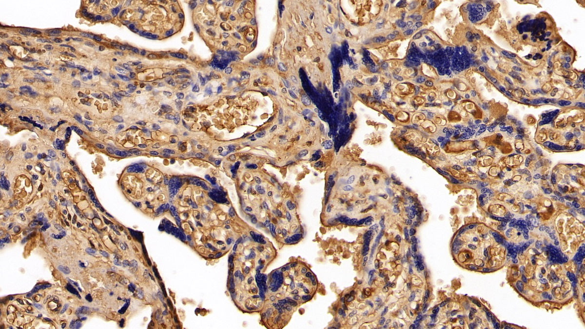 Alpha-2-Heremans Schmid Glycoprotein (AHSG) Polyclonal Antibody - image 4