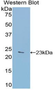 Glucosidase Alpha, Acid (GaA) Polyclonal Antibody - image 2