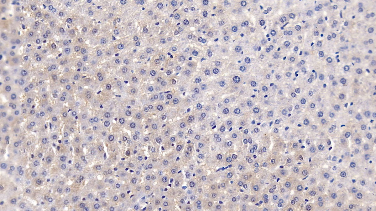 Glucosidase Alpha, Acid (GaA) Polyclonal Antibody - image 3