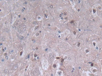 DAB staining on fromalin fixed paraffin-embedded spleen tissue)