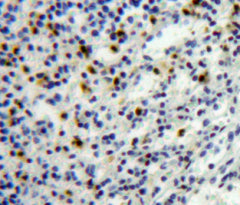 Platelet Factor 4 (PF4) Polyclonal Antibody - image 4