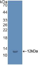 DAB staining on IHC-P; Samples: Human Kidney Tissue; Primary Ab: 10µg/ml Rabbit Anti-Multi-species Ub Antibody Second Ab: 2µg/mL HRP-Linked Caprine Anti-Rabbit IgG Polyclonal Antibody