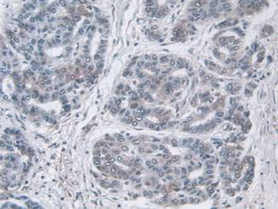 Ubiquitin (Ub) Polyclonal Antibody - image 5