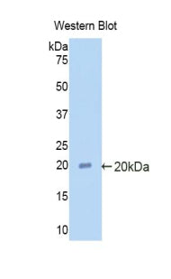 DAB staining on IHC-P; Samples: Rat Liver Tissue; Primary Ab: 30µg/ml Rabbit Anti-Rat a2PI Antibody Second Ab: 2µg/mL HRP-Linked Caprine Anti-Rabbit IgG Polyclonal Antibody