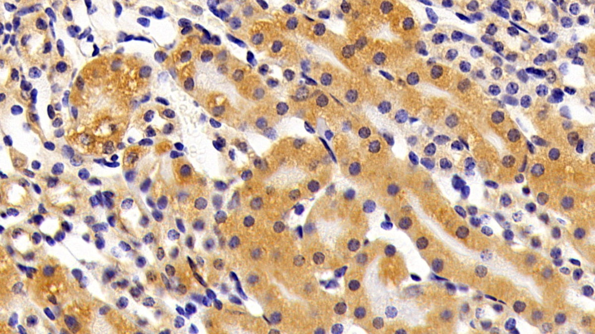Alpha 2-Antiplasmin (a2PI) Polyclonal Antibody - image 5