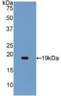 DAB staining on IHC-P; Samples: Human Liver Tissue; Primary Ab: 20μg/ml Rabbit Anti-Human a2PI Antibody Second Ab: 2µg/mL HRP-Linked Caprine Anti-Rabbit IgG Polyclonal Antibody
