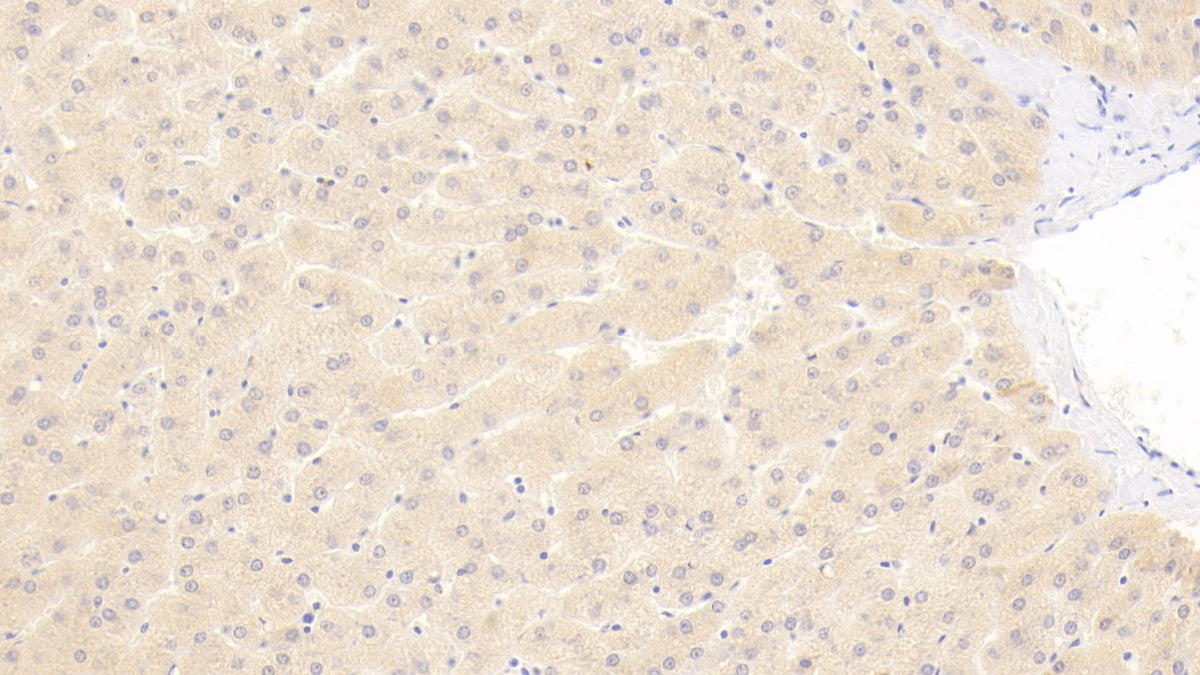 DAB staining on fromalin fixed paraffin-embedded Liver tissue)