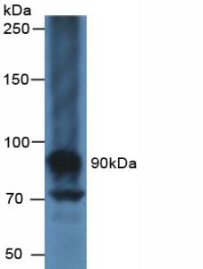 Western Blot; Sample: Recombinant CA125, Human.