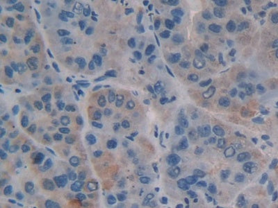 Carbohydrate Antigen 125 (CA125) Polyclonal Antibody - image 5