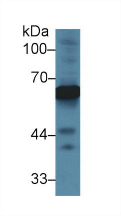 Western Blot; Sample: Recombinant protein.