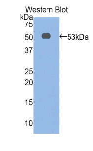 DAB staining on IHC-P; Samples: Rat Skin Tissue;  Primary Ab: 10µg/ml Rabbit Anti-Rat aFP Antibody S