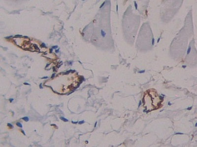 Alpha-Fetoprotein (AFP) Polyclonal Antibody - image 5