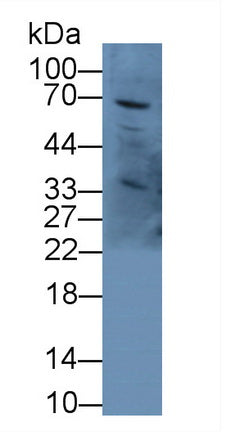 Alpha-Fetoprotein (AFP) Polyclonal Antibody - image 3