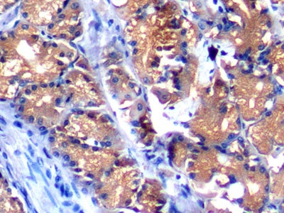 Alpha-Fetoprotein (AFP) Polyclonal Antibody - image 4
