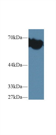 Western Blot; Sample: Recombinant protein.
