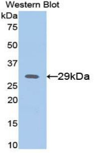 DAB staining on IHC-P; Samples: Mouse Liver Tissue; Primary Ab: 20μg/ml Rabbit Anti-Mouse aFP Antibody Second Ab: 2µg/mL HRP-Linked Caprine Anti-Rabbit IgG Polyclonal Antibody