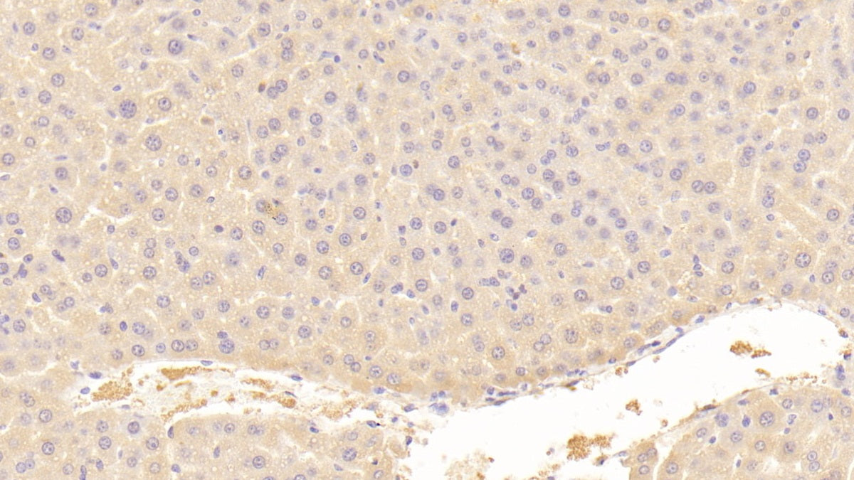 DAB staining on fromalin fixed paraffin-embedded Liver tissue)