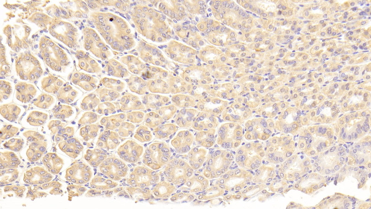 Alpha-Fetoprotein (AFP) Polyclonal Antibody - image 5