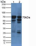 Knockout Varification: <br/>Lane 1: Wild-type HepG2 cell lysate; <br/>Lane 2: aFP knockout HepG2 cell lysate; <br/>Predicted MW: 69kDa <br/>Observed MW: 70kDa<br/>Primary Ab: 2µg/ml Rabbit Anti-Human aFP Ab<br/>Second Ab: 0.2µg/mL HRP-Linked Caprine Anti-Rabbit IgG Polyclonal Antibody<br/>