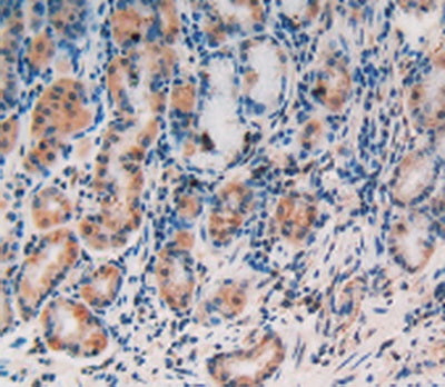 Alpha-Fetoprotein (AFP) Polyclonal Antibody - image 5